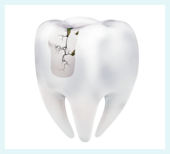 Tooth model without micelles