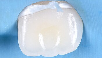 Shiny, machined tooth without white spots