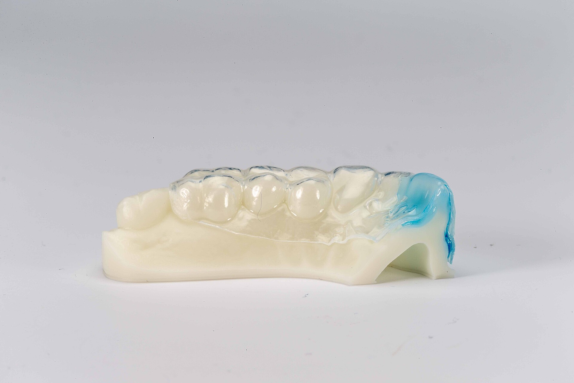 Thermoplastic bleaching tray