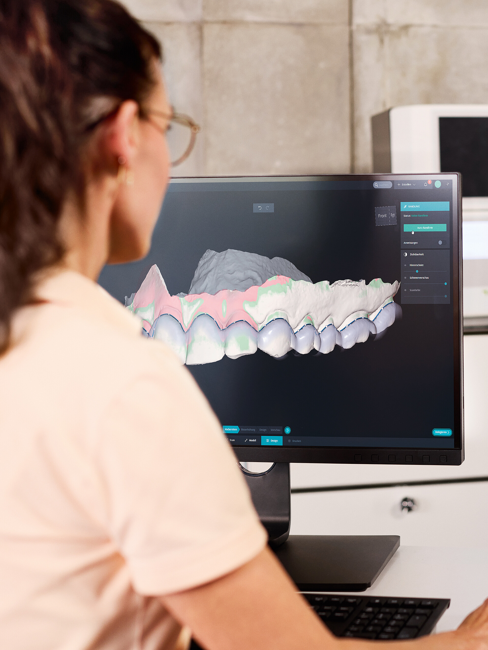 DentaMile bite splint workflow Process Tile