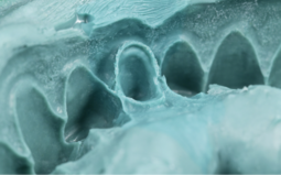 Impression of the dental arch