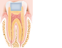 Figure: cross-section of a tooth